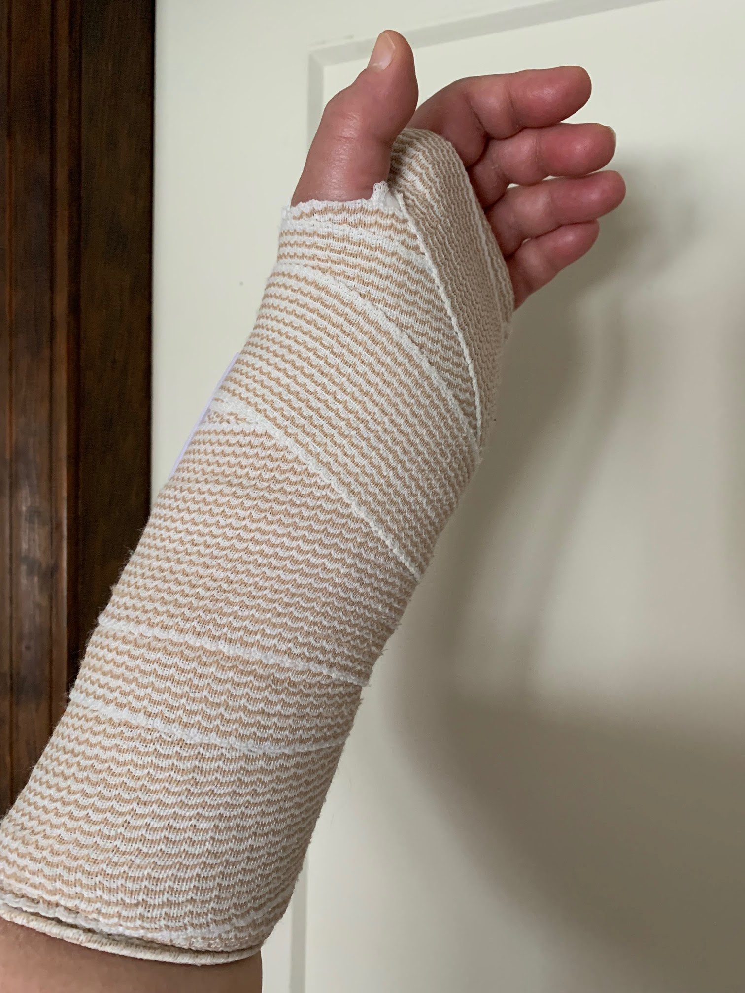 Fell on the Ice, Shattered My Wrist & Caught the Flu – When Making Happy Art Goes Wrong